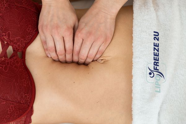 diastasis recti treatment Derby