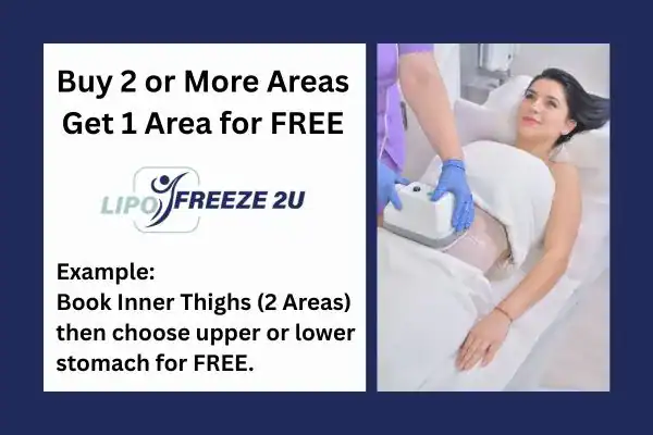 fat freezing prices Derby