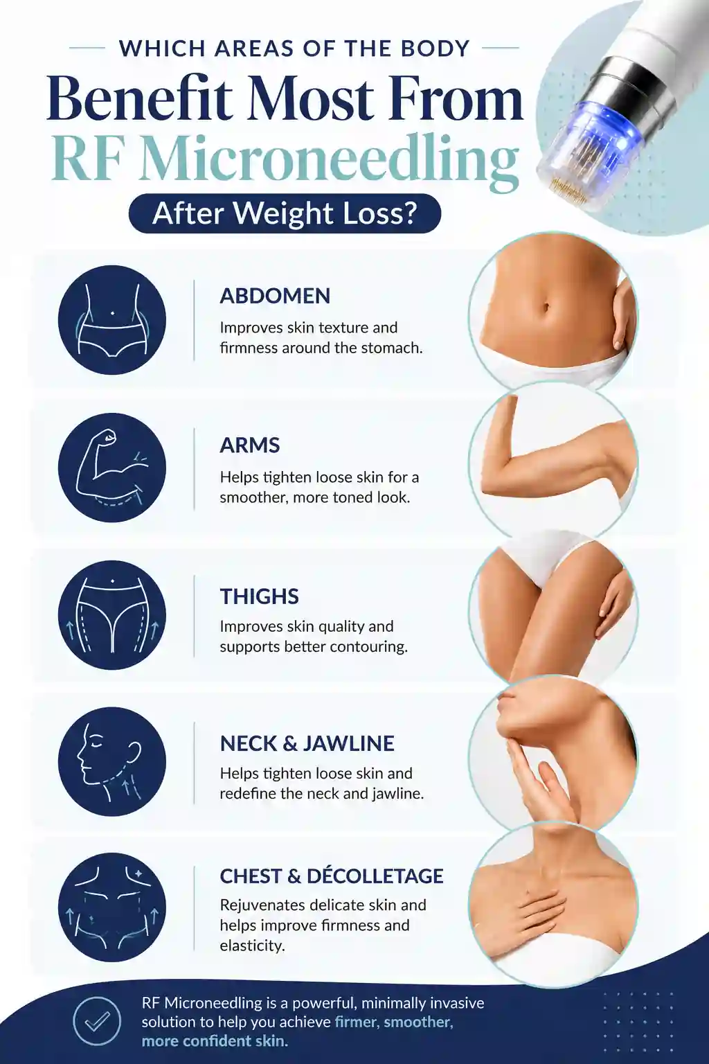 Which Areas of the Body Benefit Most From RF Microneedling After Weight Loss Derby